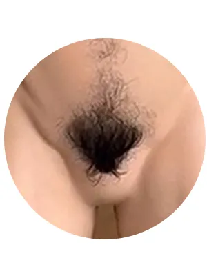 Vello púbico